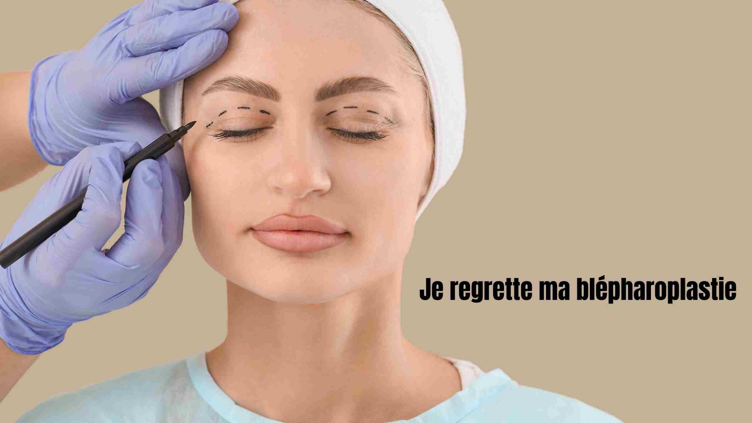Je regrette ma blépharoplastie