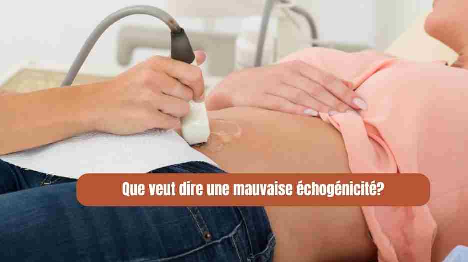 Que veut dire mauvaise échogénicité? Comprendre l’échographie