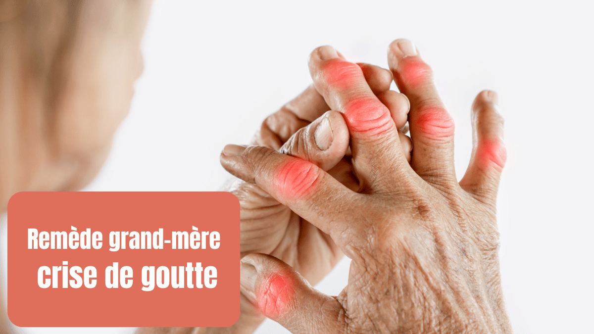 remede grand mere crise de goutte