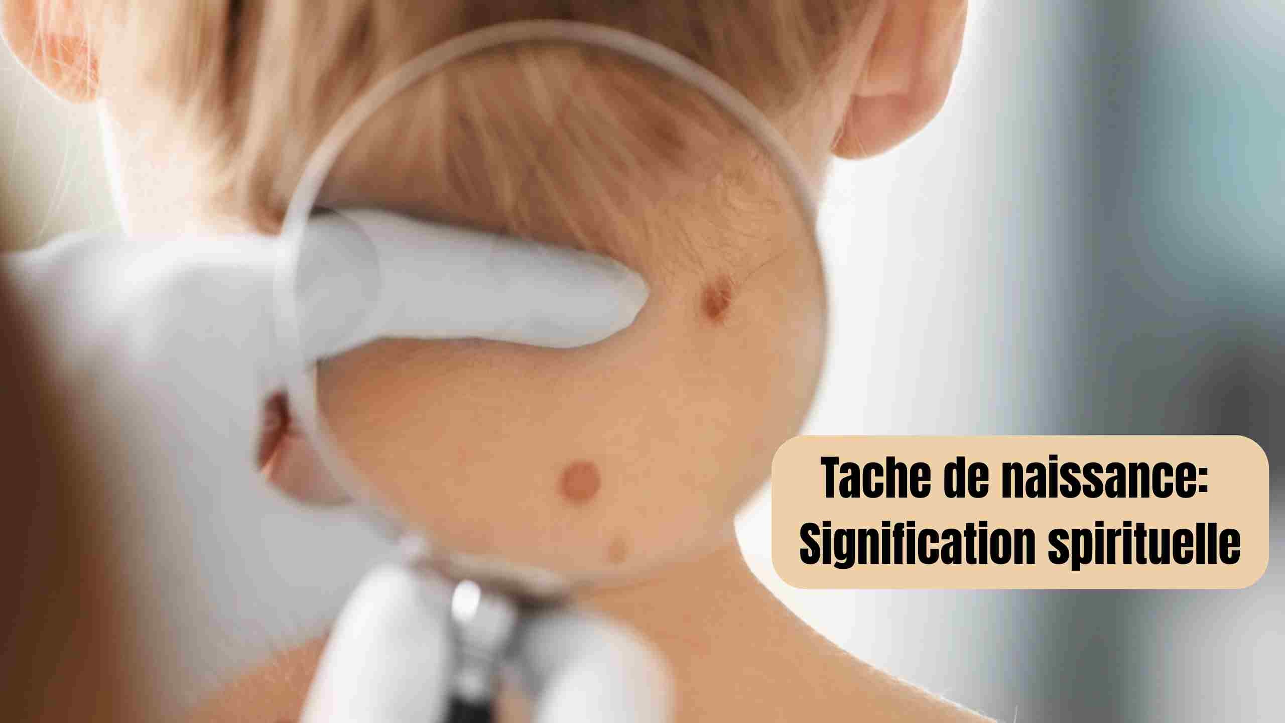 Signification spirituelle des taches de naissance