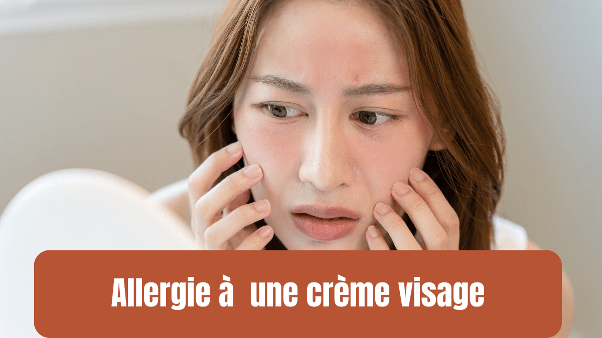 allergie creme visage