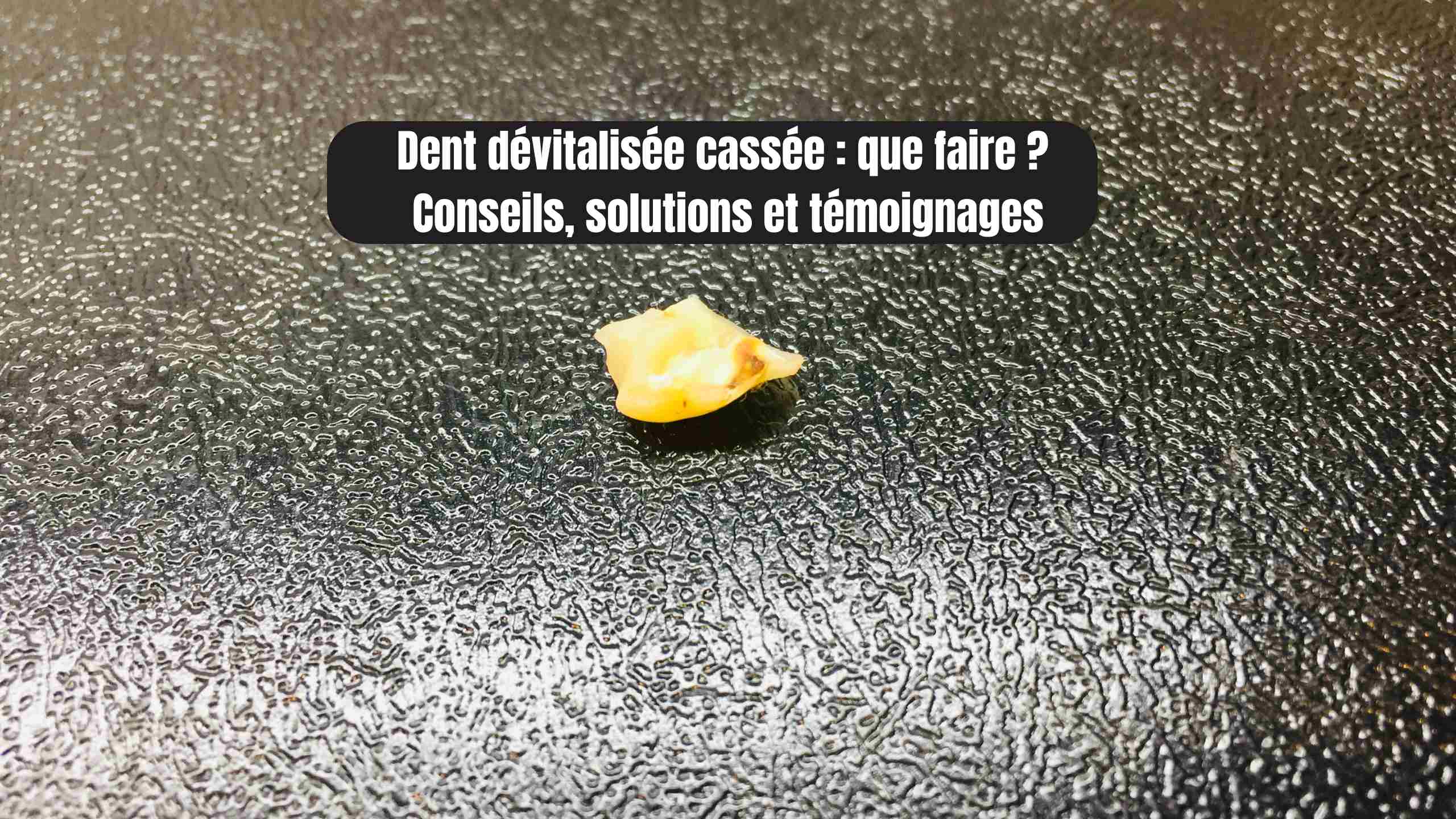 Dent dévitalisée cassée : que faire ? Conseils, solutions et témoignages