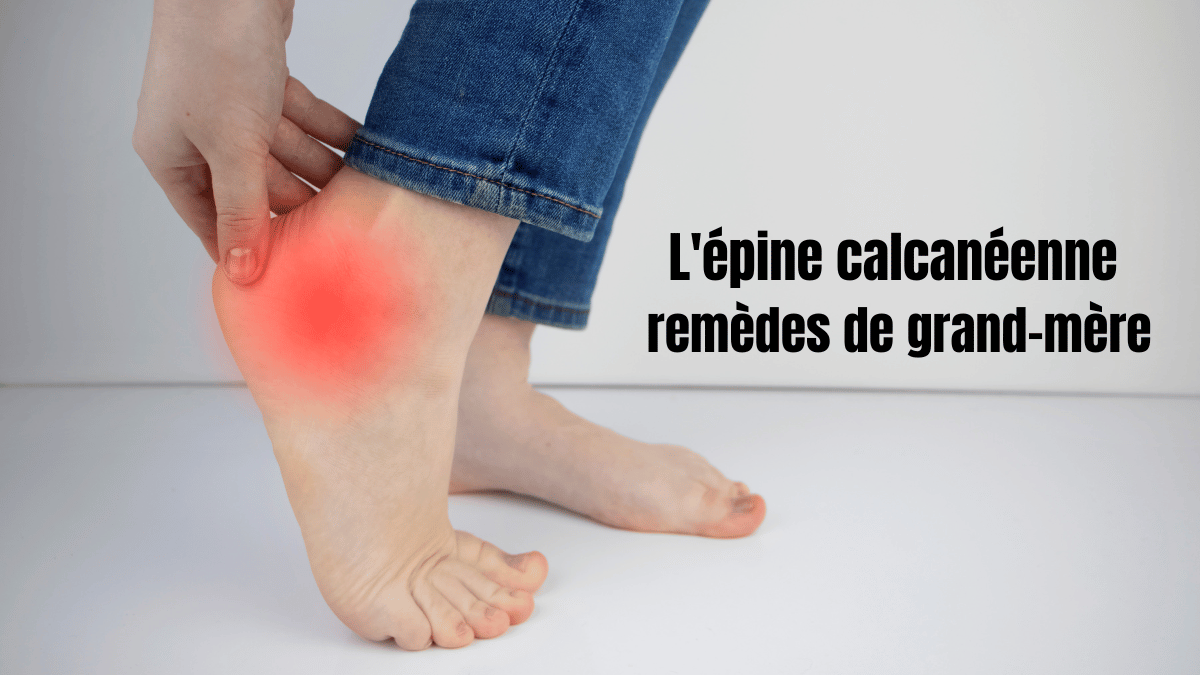 l'épine calcanéenne : Découvrez des remèdes de grand-mère