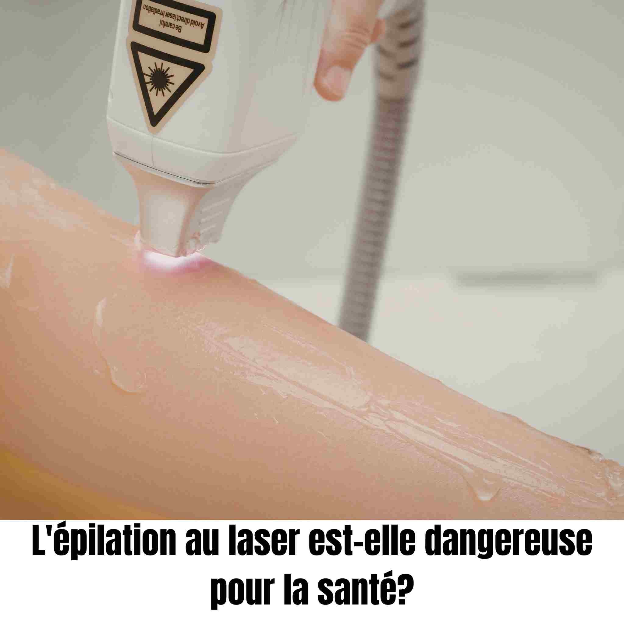 L'épilation au laser est-elle dangereuse pour la santé?