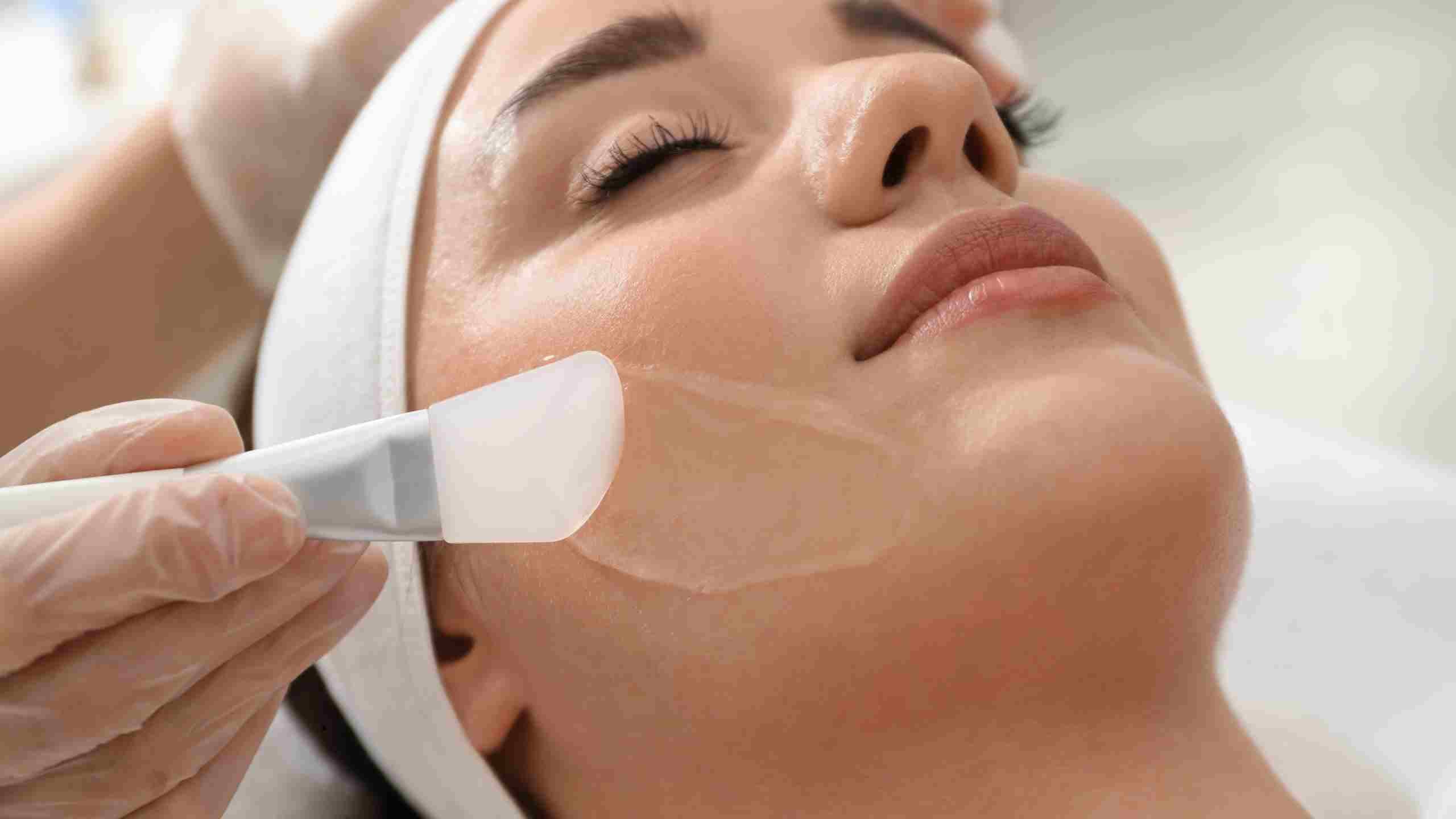 peeling TCA avant apres