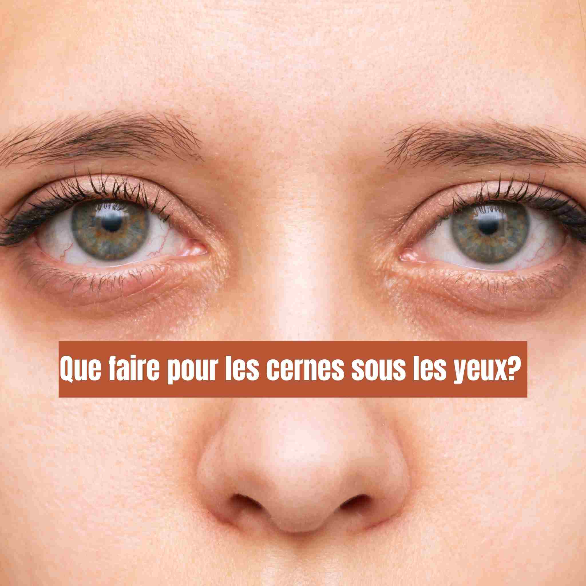 Que faire pour les cernes sous les yeux?
