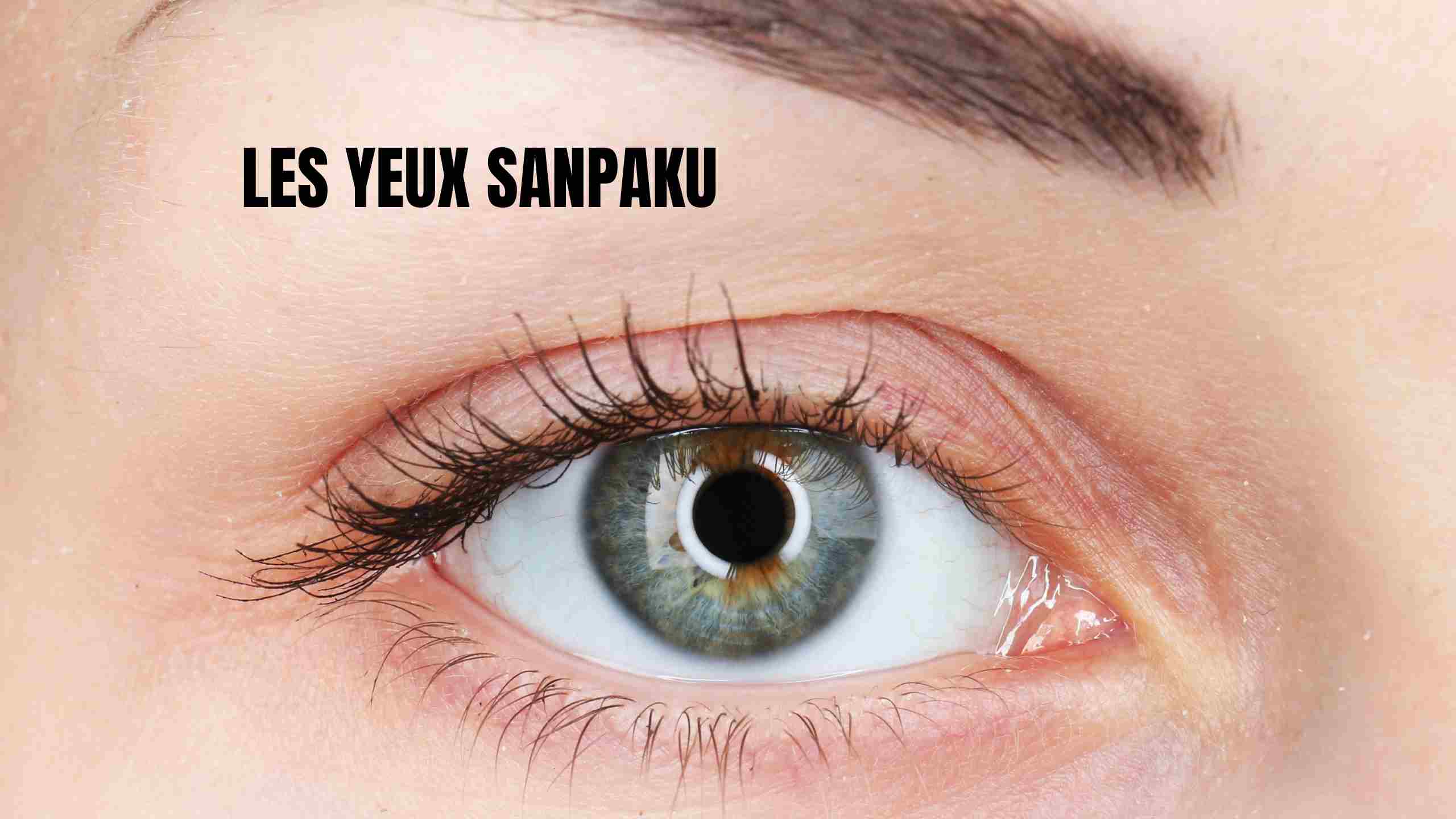 yeux sanpaku