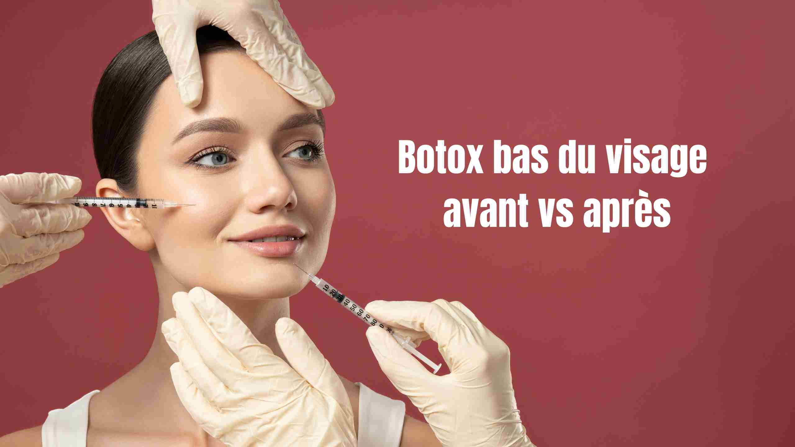 Botox bas du visage avant/après : résultats, effets et avis