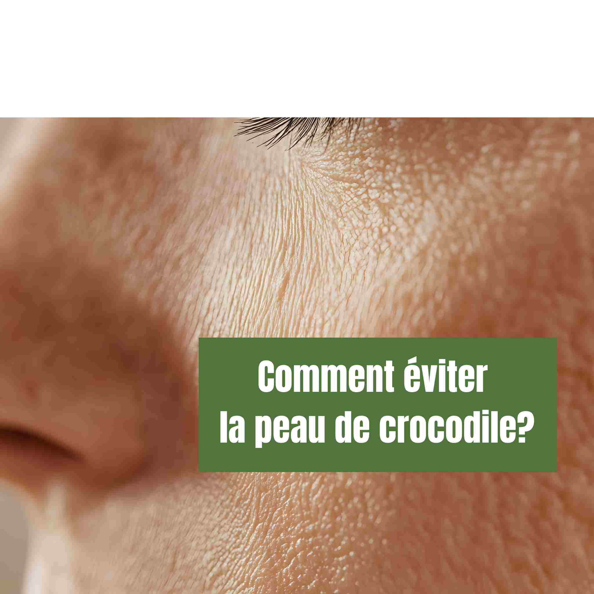 comment éviter la peau de crocodile