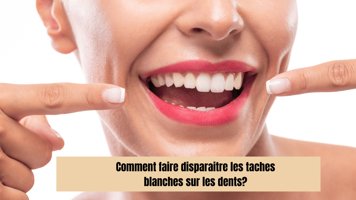 Comment faire disparaitre les taches blanches sur les dents?