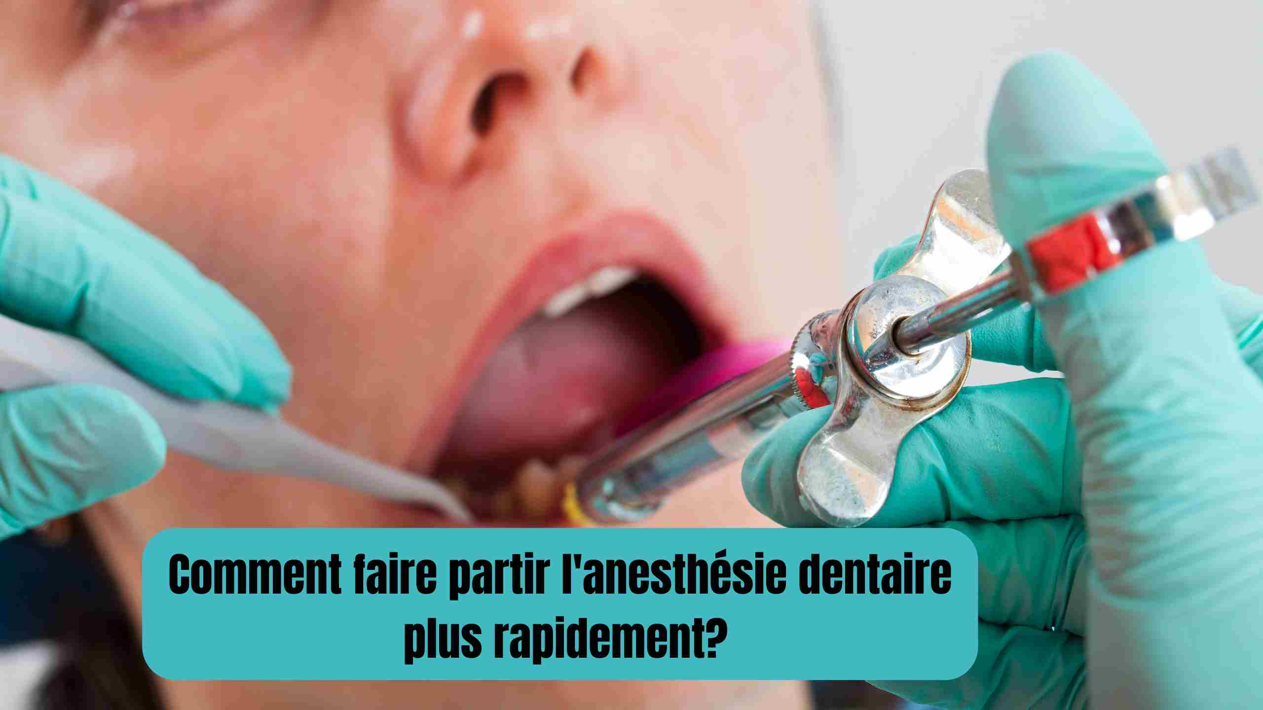 Comment faire partir l'anesthésie dentaire plus rapidement?