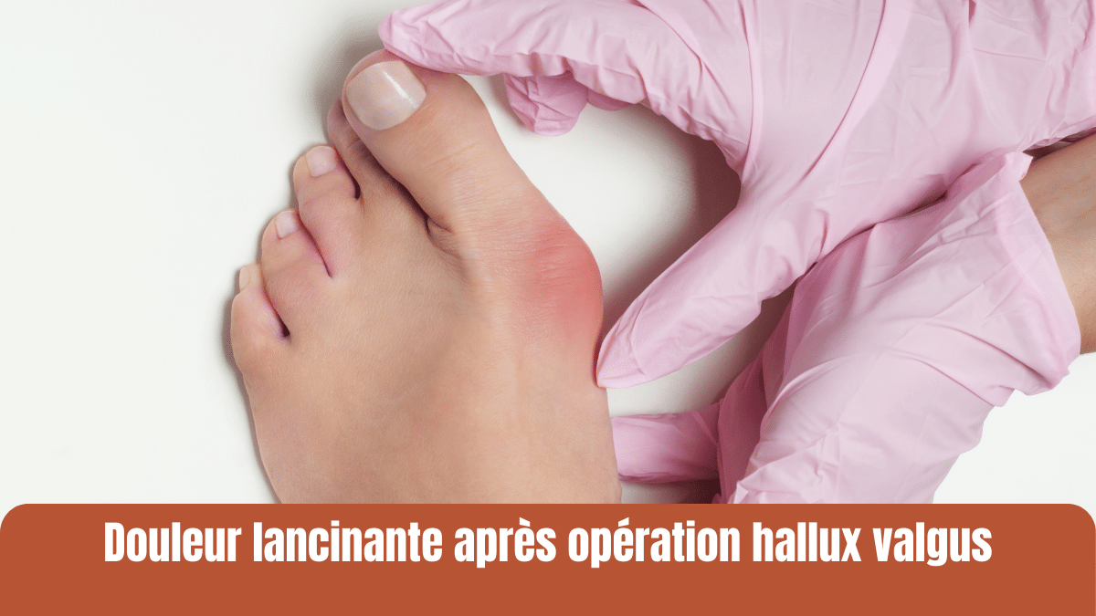 douleur lancinante après opération hallux valgus