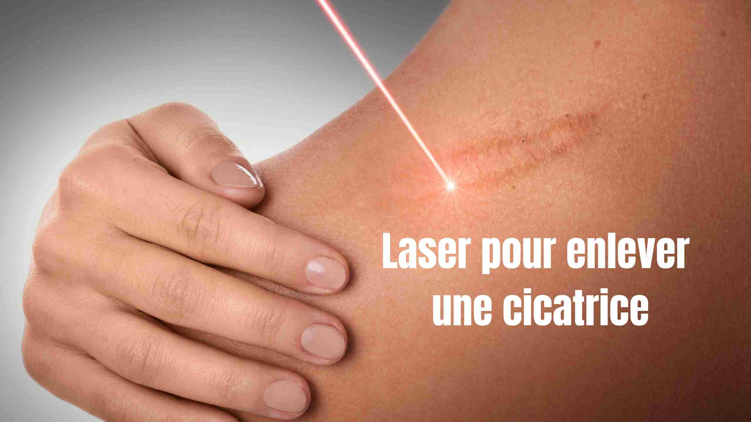 laser pour enlever cicatrice