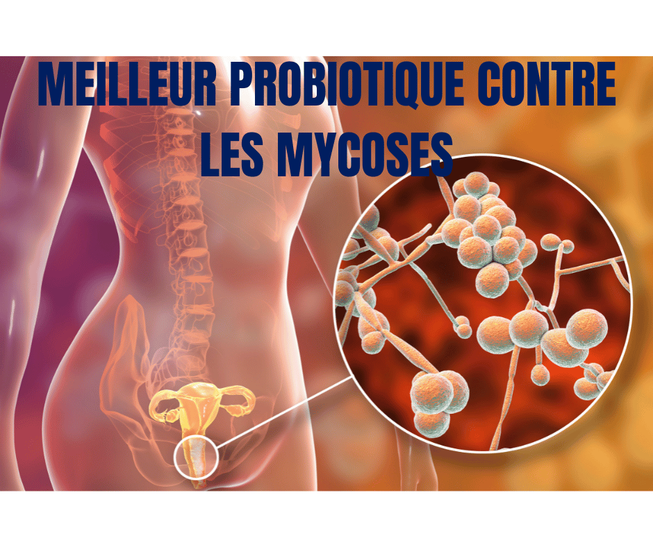 MEILLEURS PROBIOTIQUES CONTRE LES MYCOSES