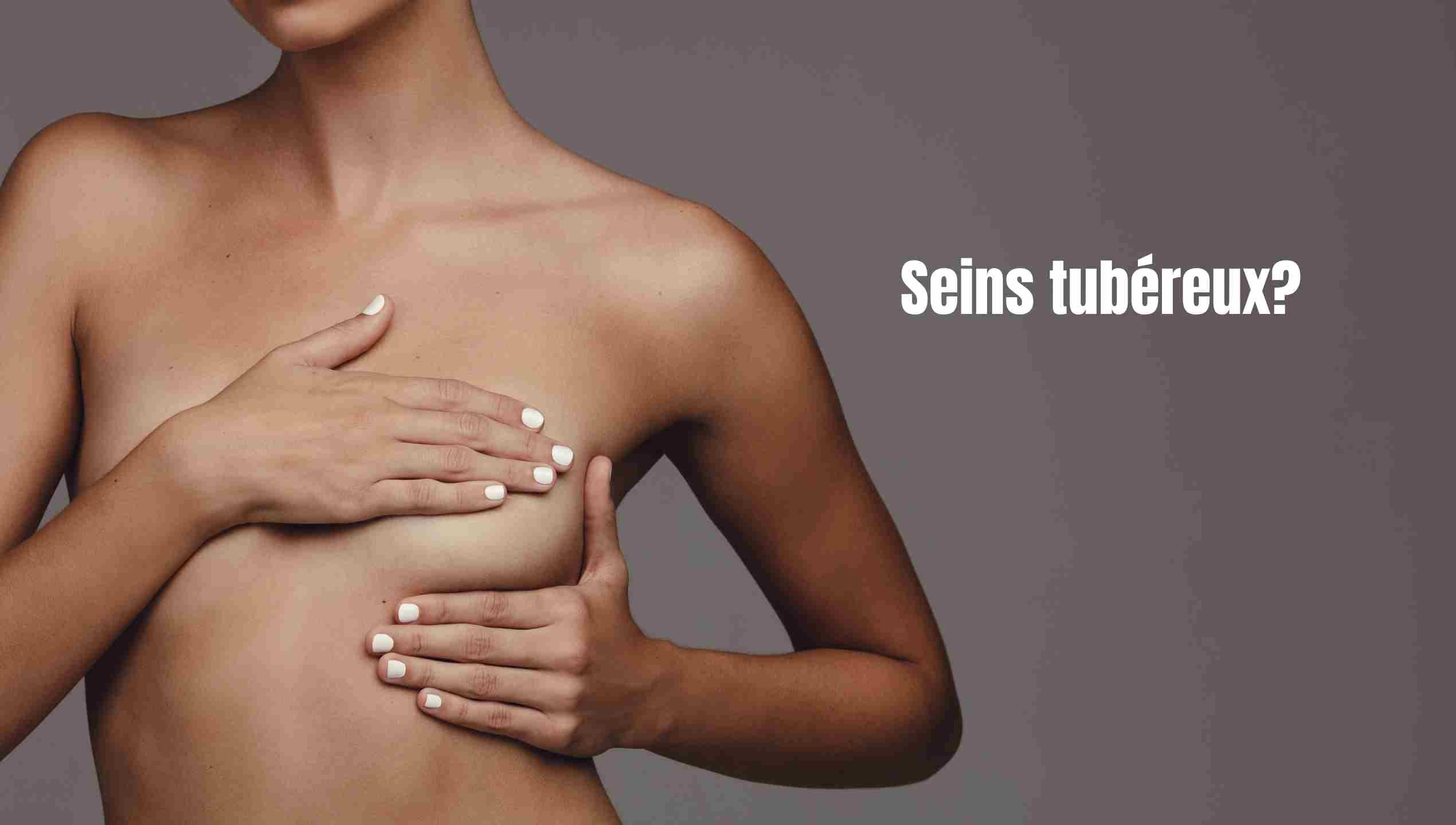 Seins tubéreux : comprendre les grades, les options de correction et les étapes 