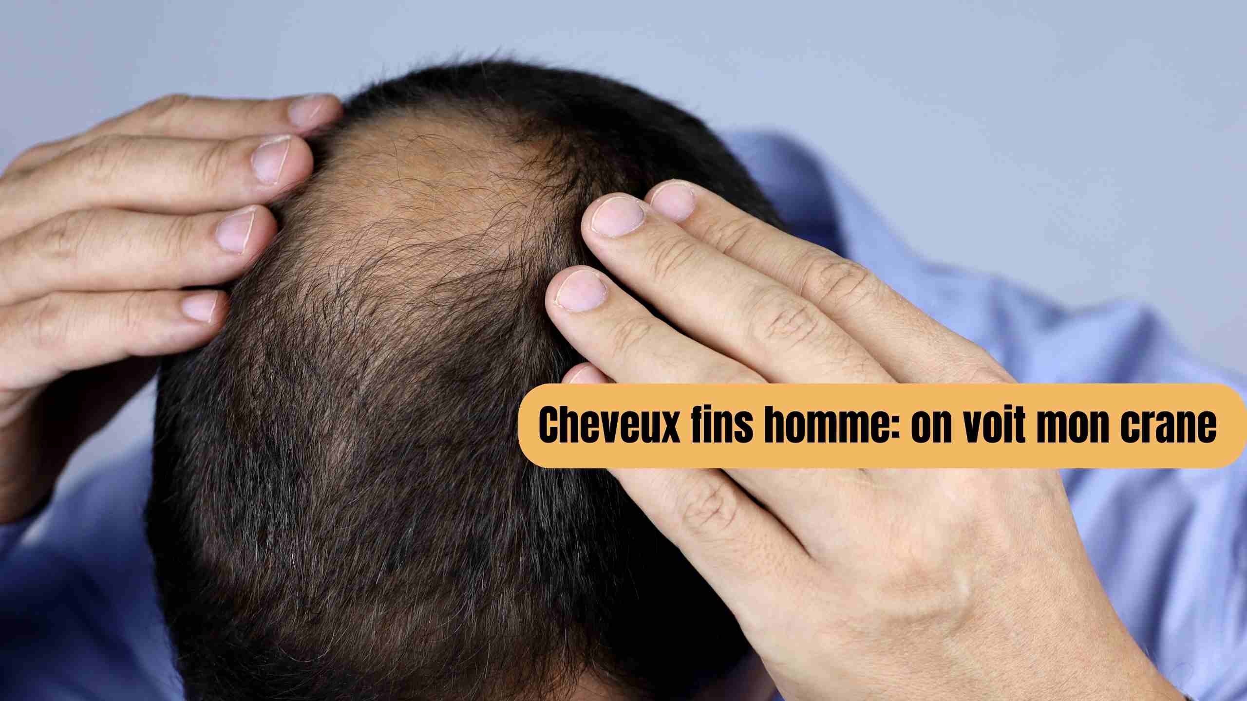 cheveux fins homme on voit mon crane