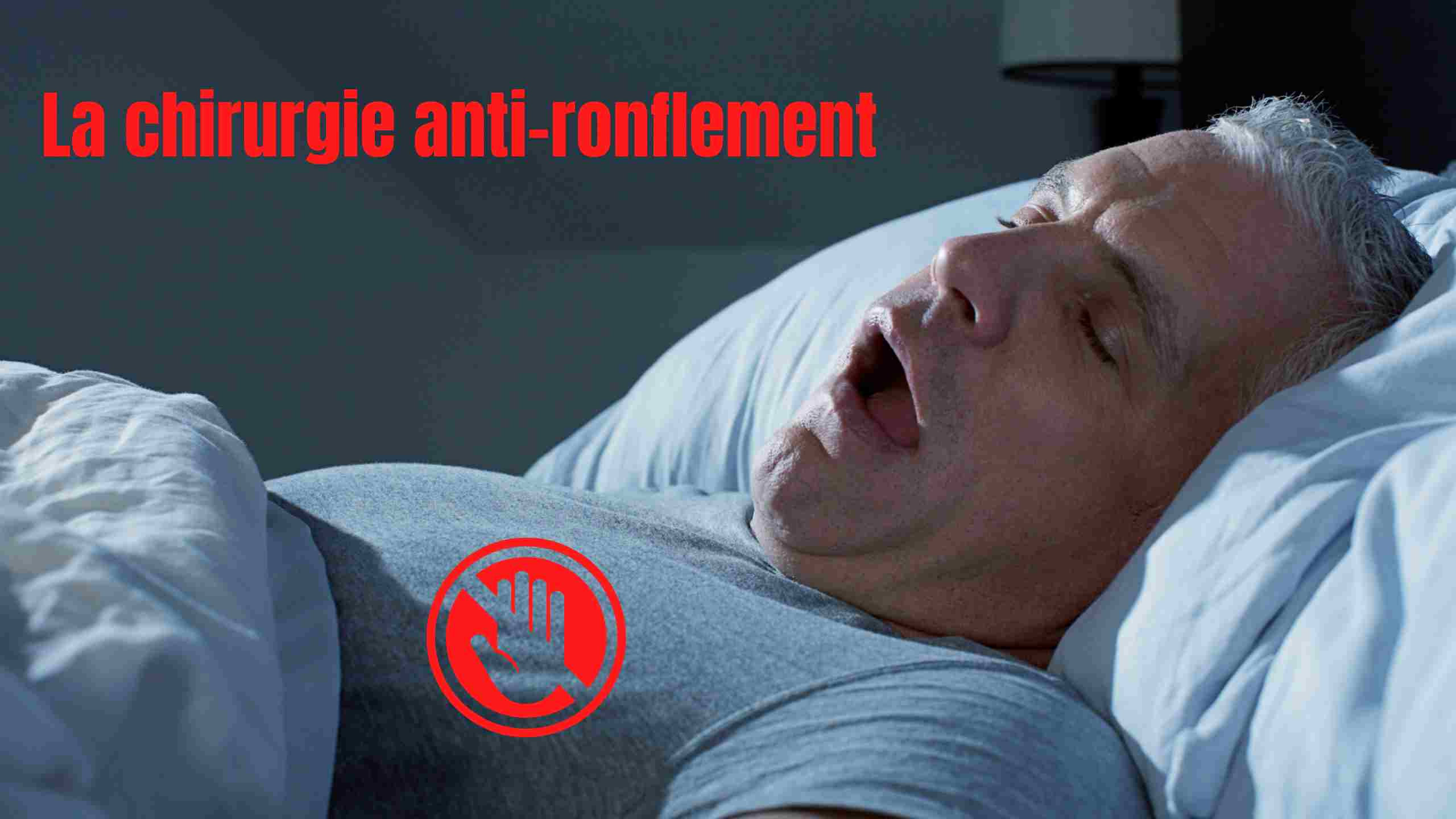 chirurgie anti ronflement