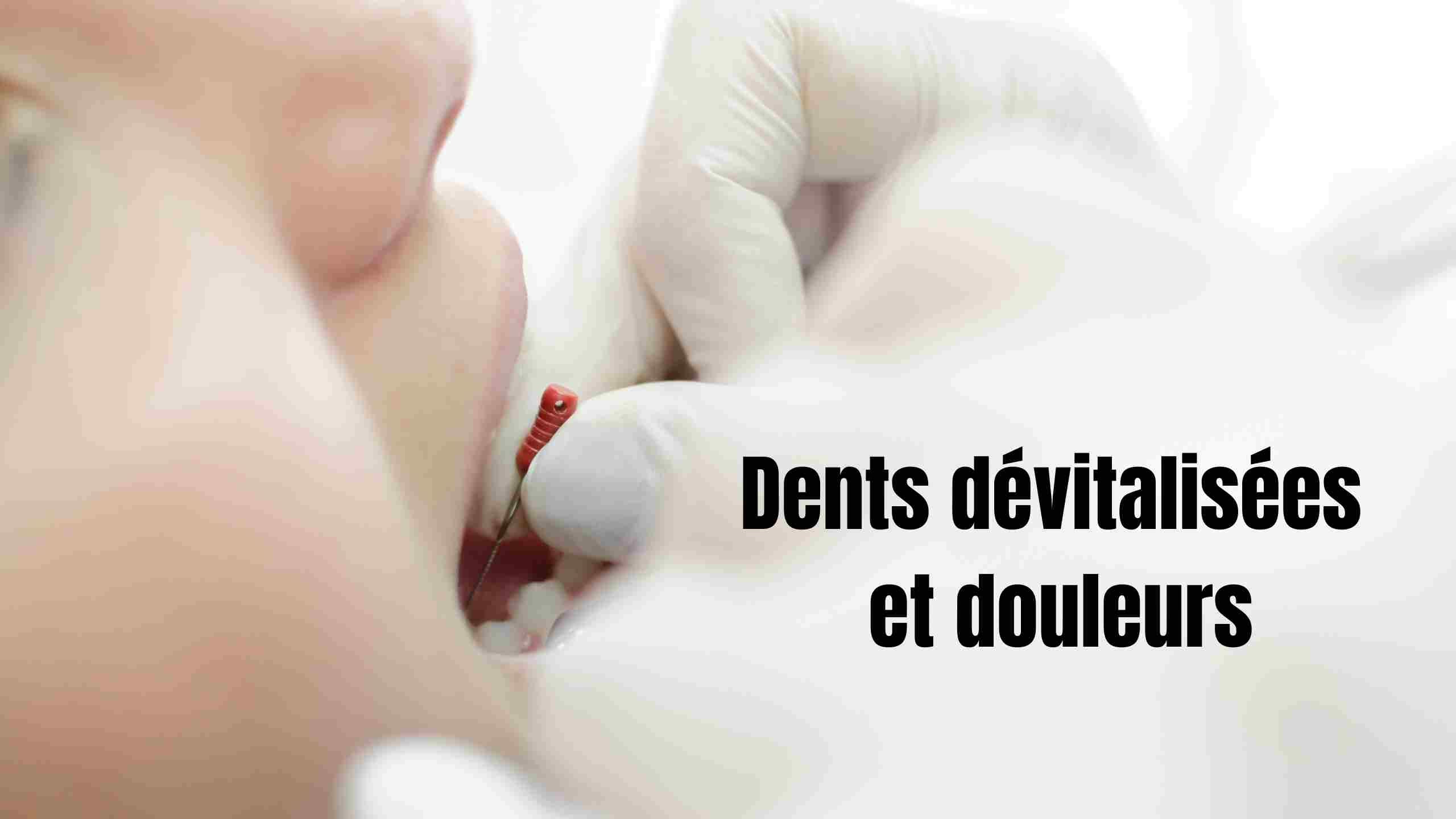 dents devitalisees et douleurs