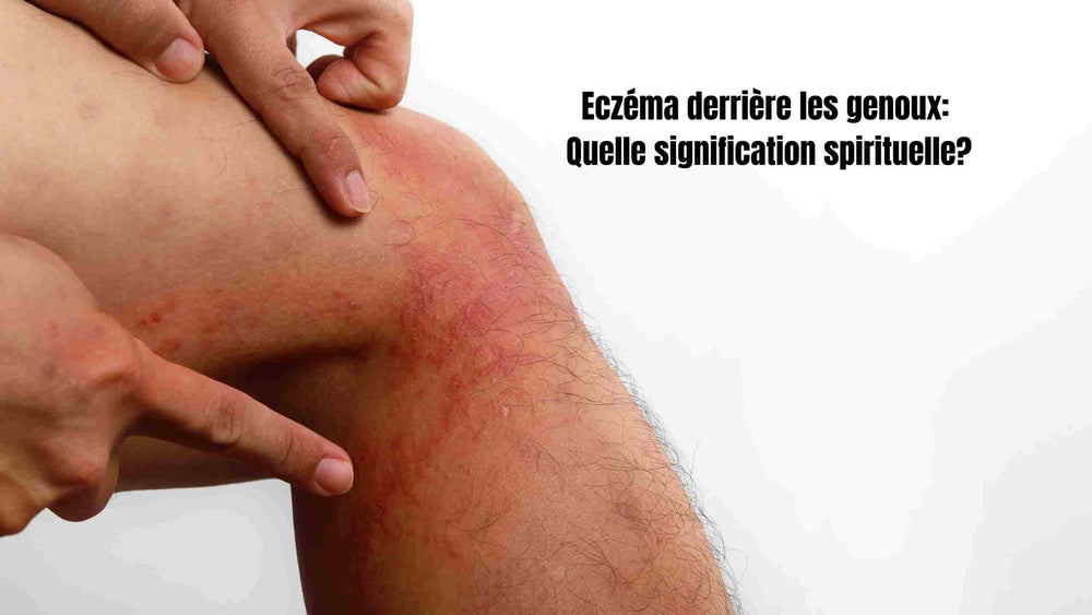 Eczéma derrière genoux Quelle signification spirituelle? — free download