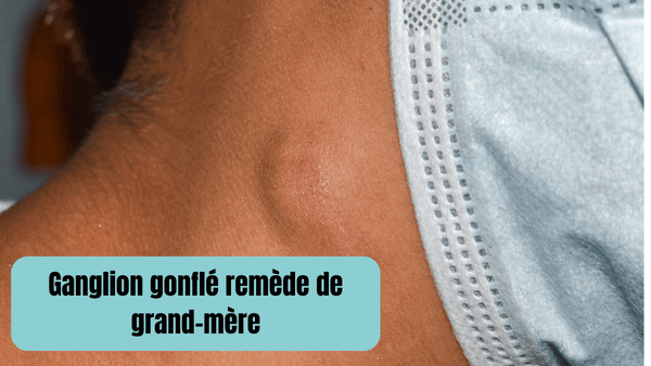 Remèdes De Grand Mère Pour Soulager Un Ganglion Gonflé Efficacement Mélusine Paris 