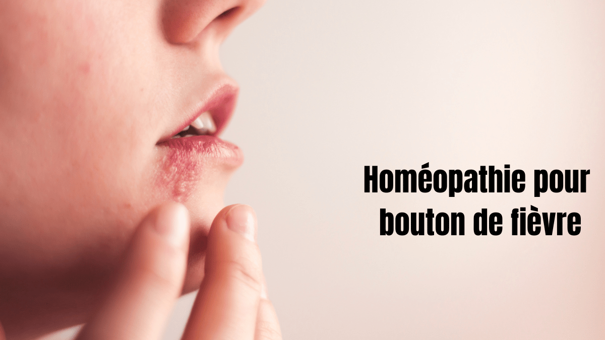 homéopathie pour bouton de fièvre