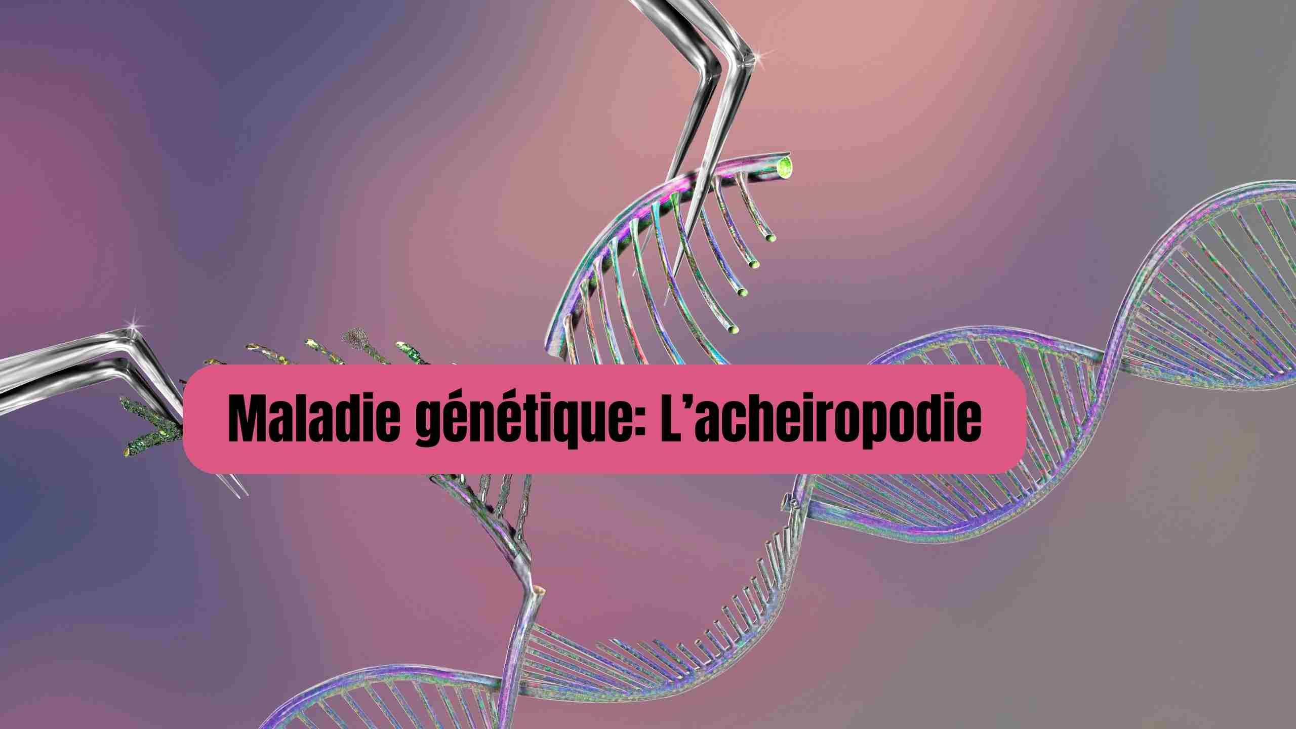 Acheiropodie : tout savoir sur cette maladie génétique rare