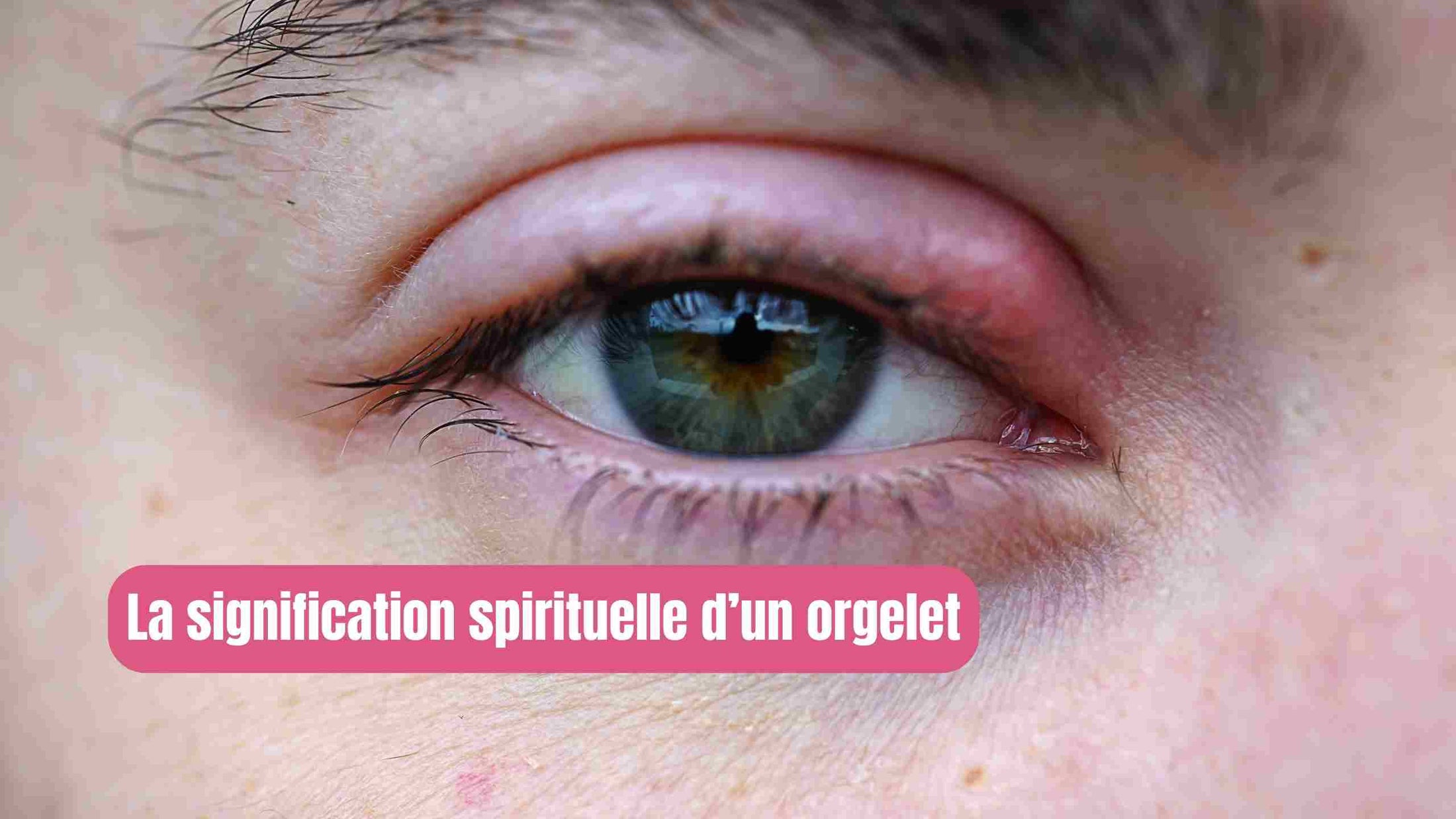 œil Droit Qui Pleure Signification Spirituelle Orgelet à l’œil : signification spirituelle, émotionnelle et symboliqu