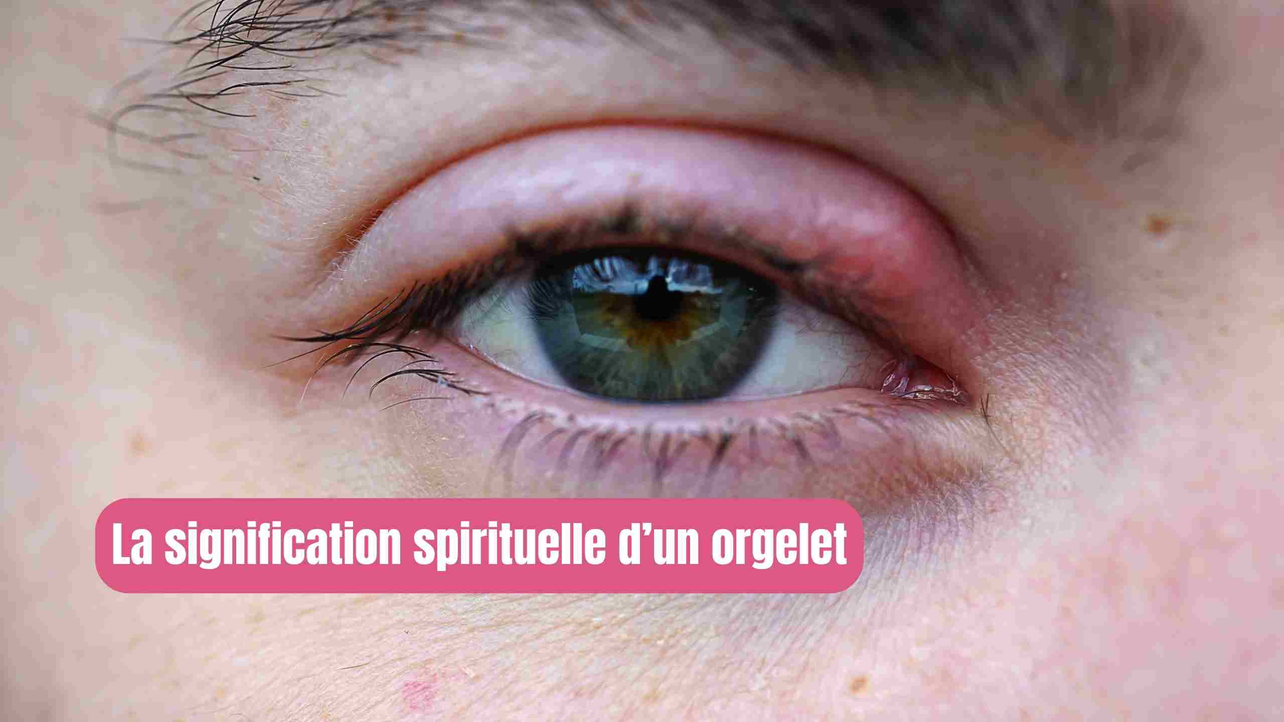Orgelet à l’œil : signification spirituelle, émotionnelle et symbolique