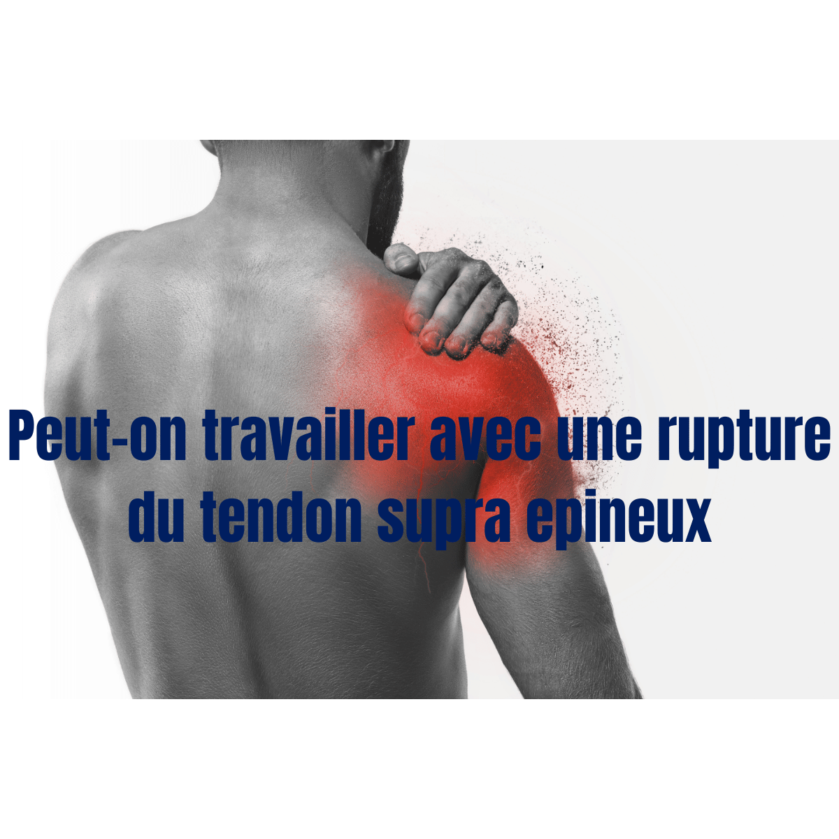 peut-on travailler avec une rupture du tendon supra epineux