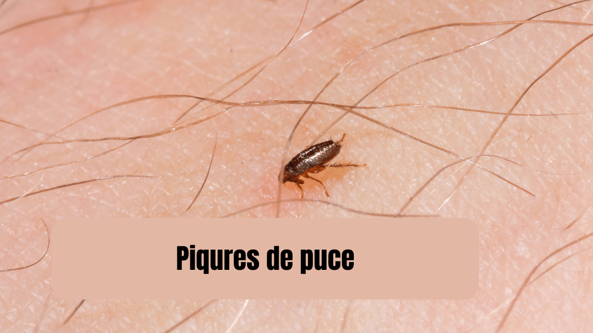 piqure de puce