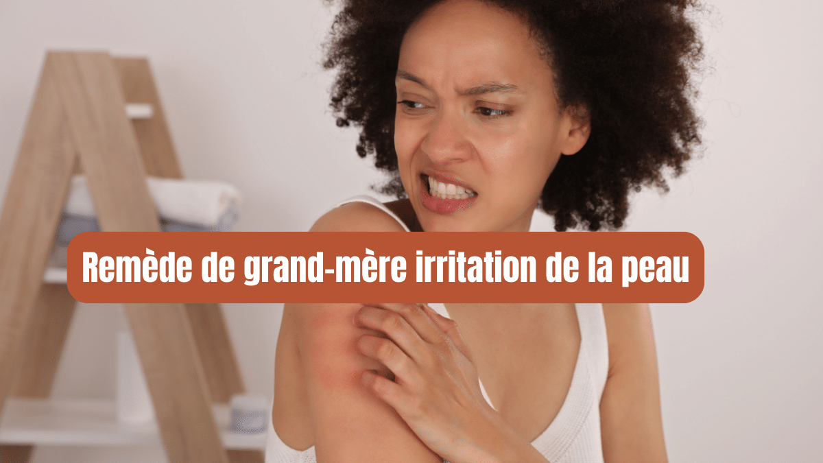 remede de grand mere irritation de la peau 