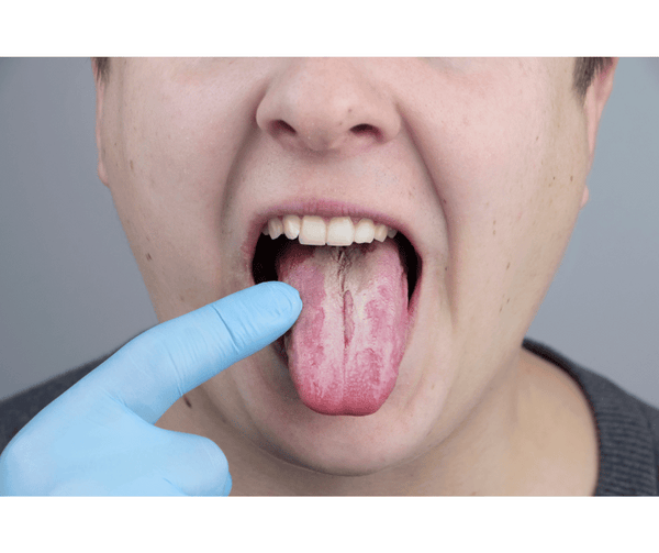 Remède de grand mère pour nettoyer la langue