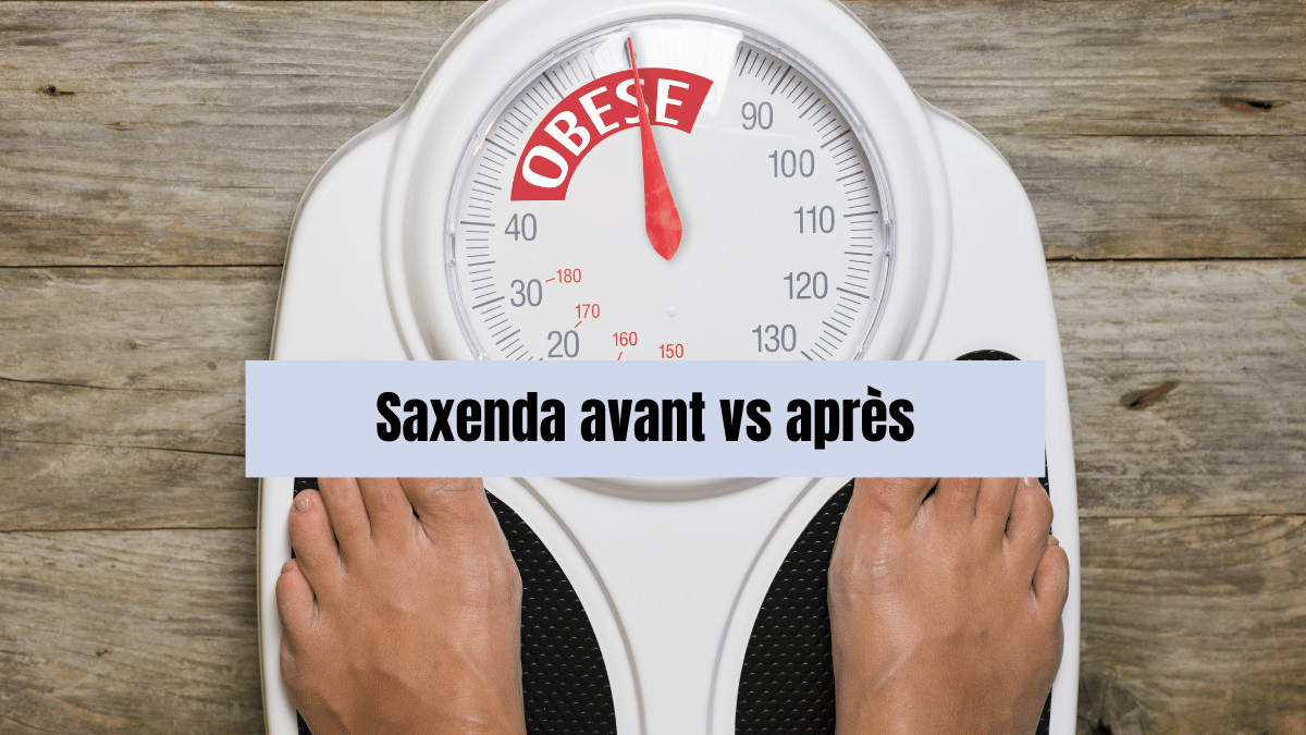 saxenda avant apres