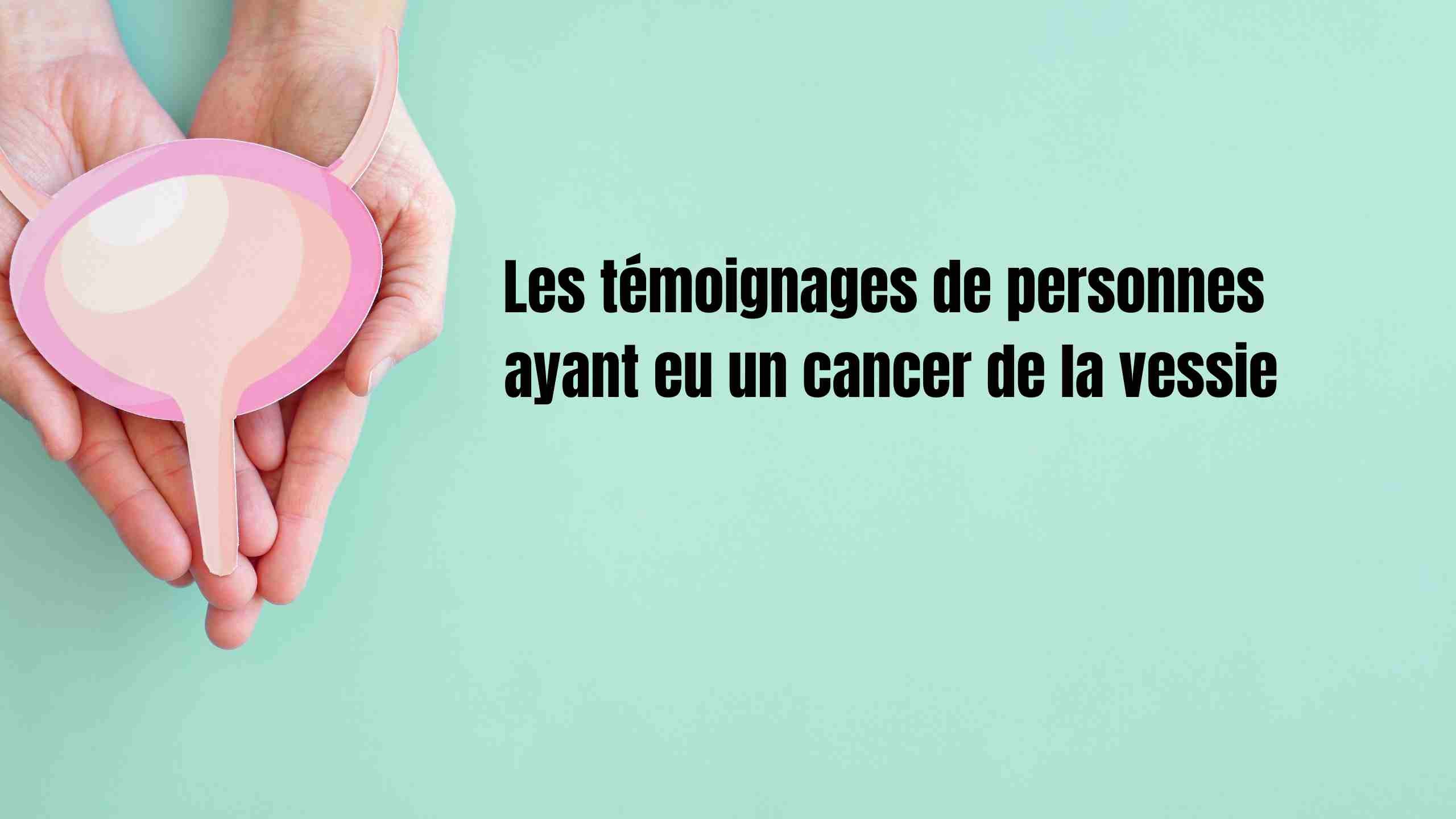 Les témoignages de personnes ayant eu un cancer de la vessie