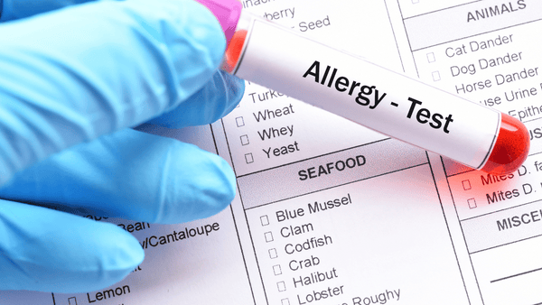 test allergie pharmacie