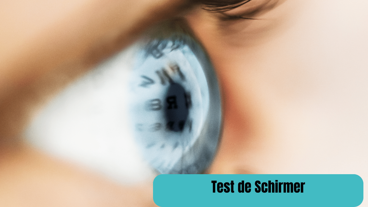 test de Schirmer